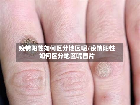 疫情阳性如何区分地区呢/疫情阳性如何区分地区呢图片-第3张图片