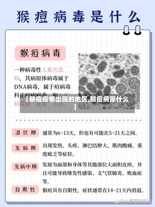 【猴痘疫情出现的地区,猴痘病是什么】-第2张图片